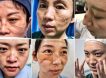 Вот как выглядят лица врачей в Ухани после смены