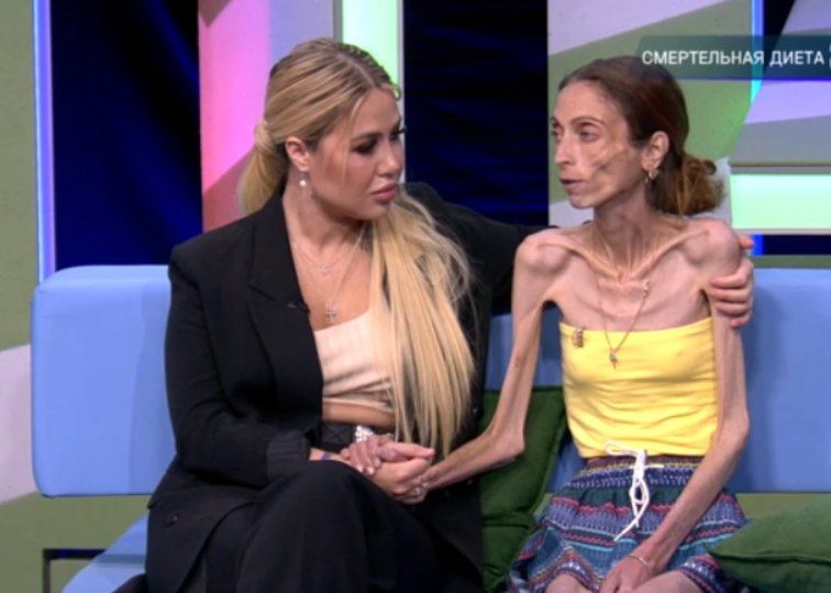 «Организм съел все мышцы»: из студии шоу «За гранью» госпитализировали участницу, которая весит 20 кг