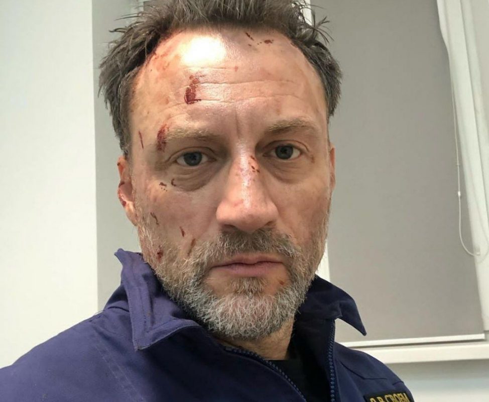 Во Франции отменили гастроли сбежавшего из России Анатолия Белого